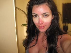 Kim Kardashian sin maquillaje, reportando su quemadura facial.