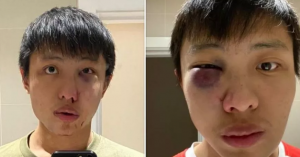 joven golpeado coronavirs