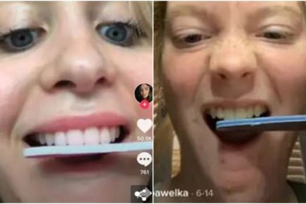 Limarse los dientes: el peligroso nuevo reto de TikTok