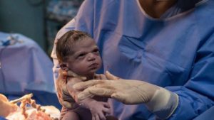 Viral: fotógrafo se reencontró con la “bebé enojada” que se convirtió en meme en redes