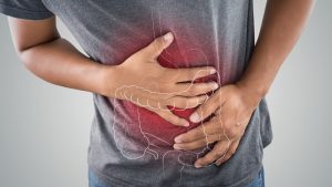 Paciente con dolor abdominal tenía una pesa de 2 kg en su recto