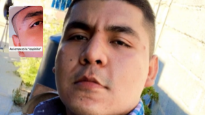 140922-viral- TikTok