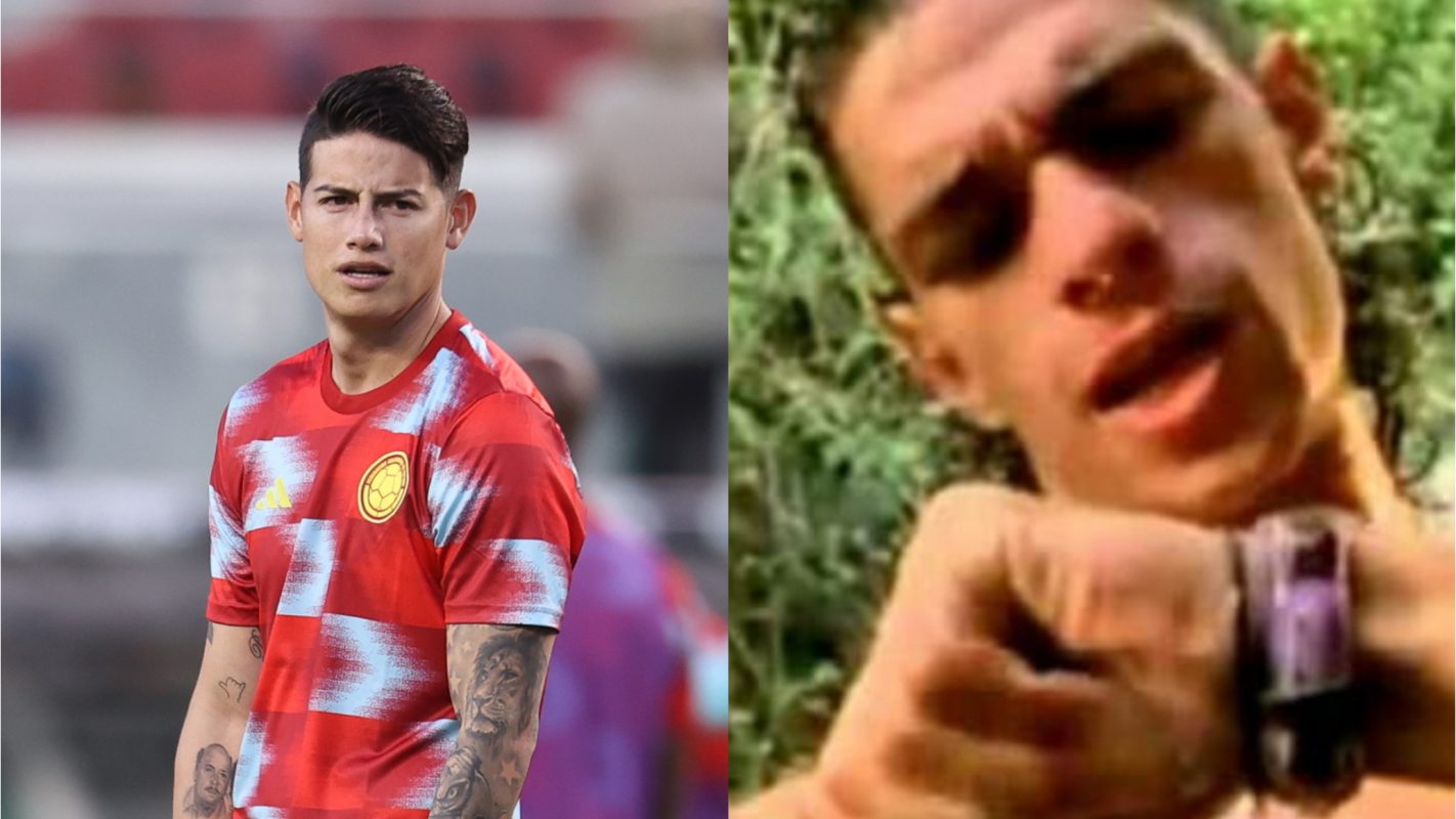 James Rodríguez lesión