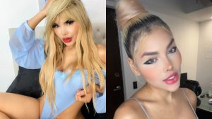 “Soy una rata de laboratorio”: modelo revela cómo cambió su color de piel