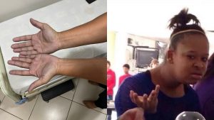 Idiota de la semana: llegó al médico con las manos azules y el diagnóstico fue insólito