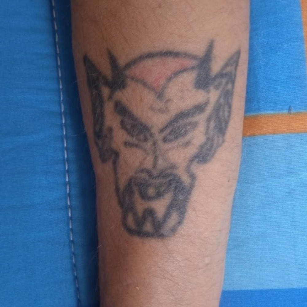 Nuestro oyente fue el conejillo de indias y le dejaron un horrible tatuaje.