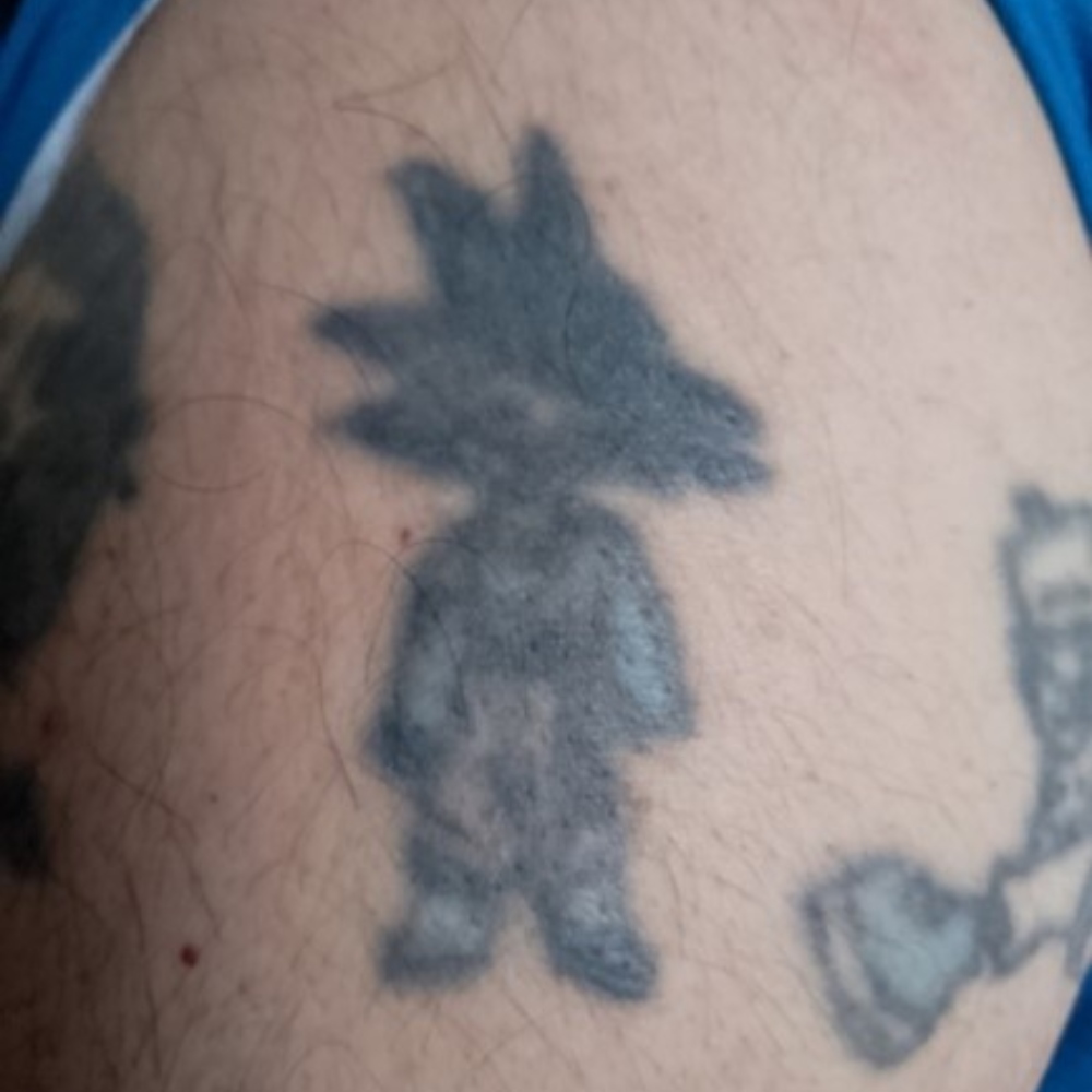 Nuestro oyente no tenía dinero y le quedó bien feo el tatuaje.