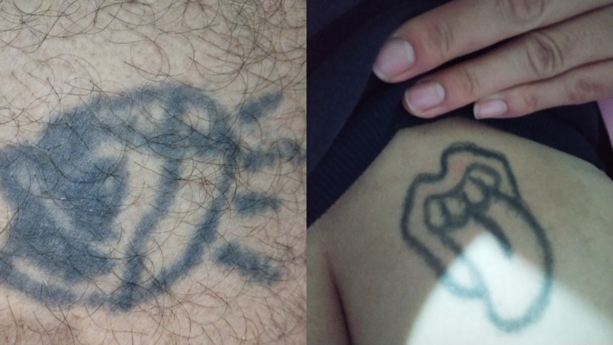 Estos son los peores tatuajes que los oyentes quieren que les arreglemos en Radioacktiva