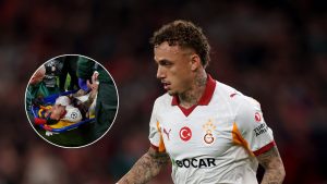 ¡Terror en la Champions League! Jugador casi se mutila un dedo en pleno partido: fotos estremecedoras