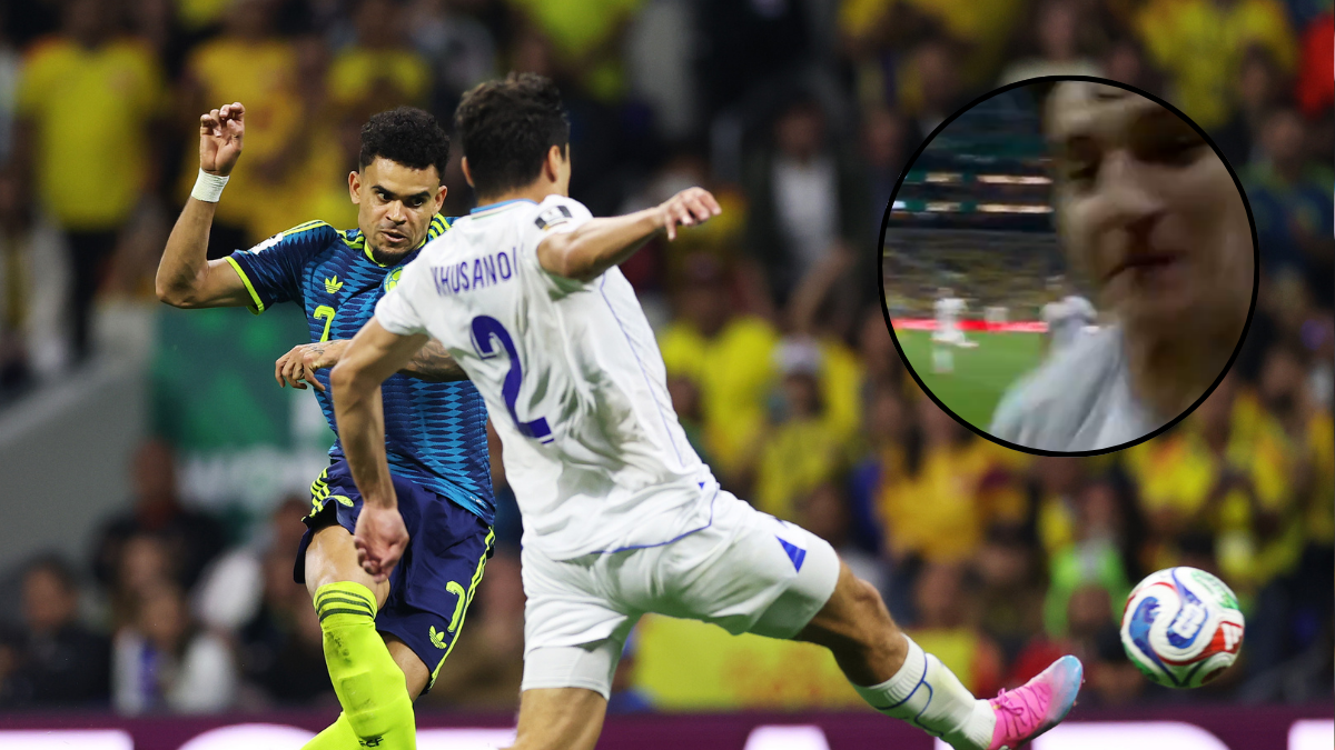 Así quedó el camarógrafo después del duro choque en el Uzbekistán vs Colombia: no pudo continuar