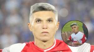 Imágenes muestran como quedó el rostro de Daniel Torres después de agresión con moneda en Santa Fe vs DIM